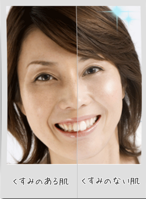 HPT4JyegHMJKgm01492298627_1492298773.png