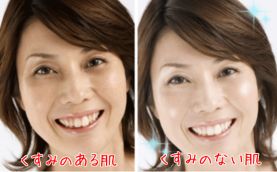 nAlpGHjRCo1V7Ap1506407474_1506407848.png